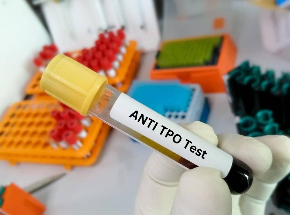 Anti-TPO antibody (Anti-Thyroid Peroxidase)