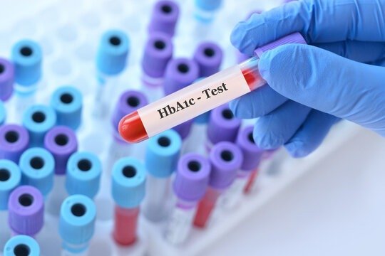 HbA1c