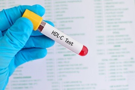 HDL CHOLESTEROL - DIRECT