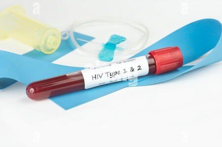 HIV I and II