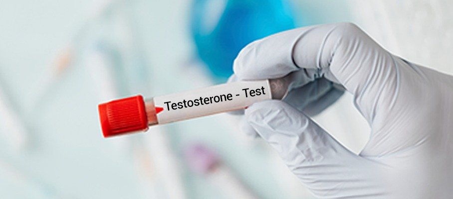 TESTOSTERONE