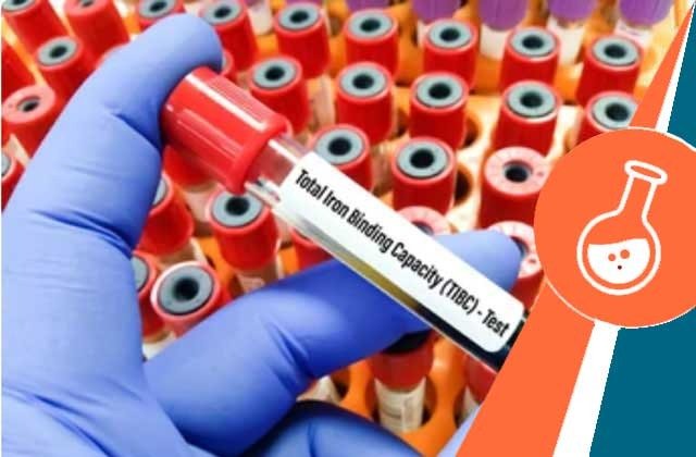 TOTAL IRON BINDING CAPACITY (TIBC)