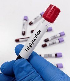 TRIGLYCERIDES