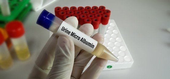 URINE CULTURE AND SUSCEPTIBILITY